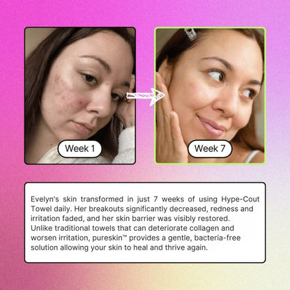 Hype-Cout Daily Clean Facial Towels